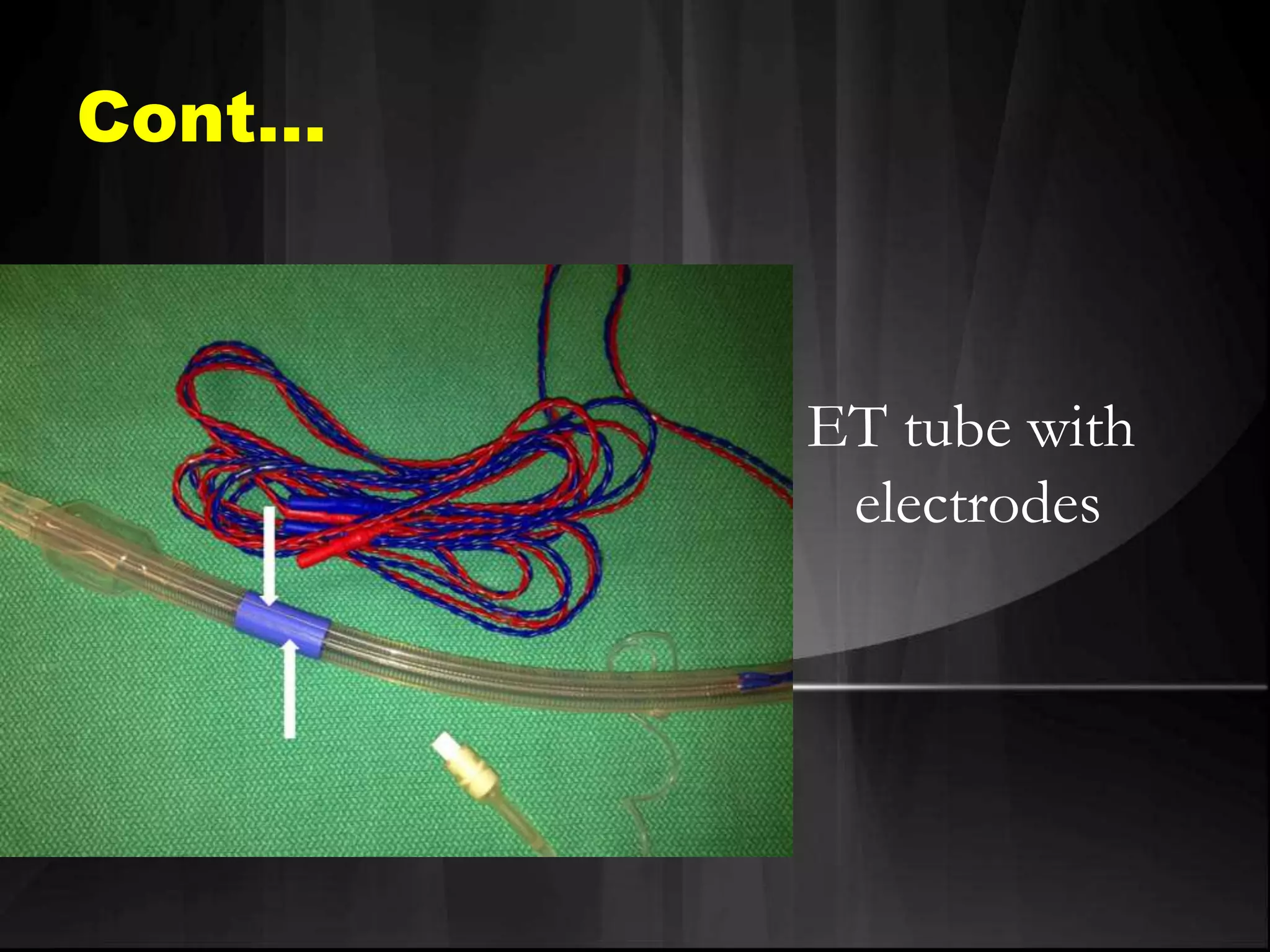 Cont…
ET tube with
electrodes
 