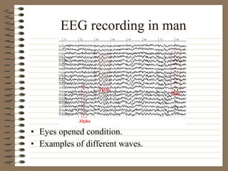 EEG recording in man
• Eyes opened condition.
• Examples of different waves.
 