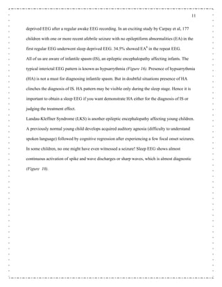 11
deprived EEG after a regular awake EEG recording. In an exciting study by Carpay et al, 177
children with one or more recent afebrile seizure with no epileptiform abnormalities (EA) in the
first regular EEG underwent sleep deprived EEG. 34.5% showed EA8
in the repeat EEG.
All of us are aware of infantile spasm (IS), an epileptic encephalopathy affecting infants. The
typical interictal EEG pattern is known as hypsarrythmia (Figure 16). Presence of hypsarrythmia
(HA) is not a must for diagnosing infantile spasm. But in doubtful situations presence of HA
clinches the diagnosis of IS. HA pattern may be visible only during the sleep stage. Hence it is
important to obtain a sleep EEG if you want demonstrate HA either for the diagnosis of IS or
judging the treatment effect.
Landau-Kleffner Syndrome (LKS) is another epileptic encephalopathy affecting young children.
A previously normal young child develops acquired auditory agnosia (difficulty to understand
spoken language) followed by cognitive regression after experiencing a few focal onset seizures.
In some children, no one might have even witnessed a seizure! Sleep EEG shows almost
continuous activation of spike and wave discharges or sharp waves, which is almost diagnostic
(Figure 10).
 