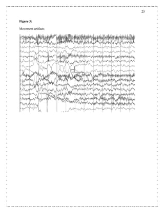 2323
igure 3:
Movement artifacts
F
 
