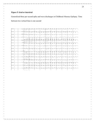 25
eneralized three per second spike and wave discharges in Childhood Absence Epilepsy. Time
et
Figure 5: Ictal or interictal
G
b ween two vertical lines is one second
 
