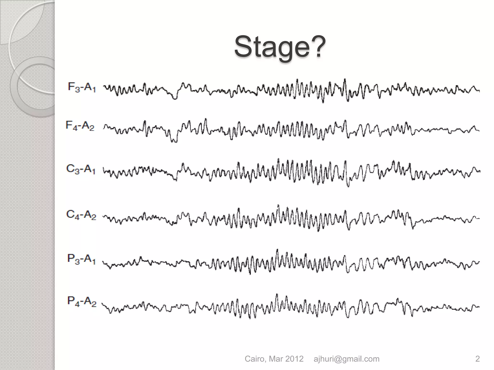 EEG for sleep lab | PPTX