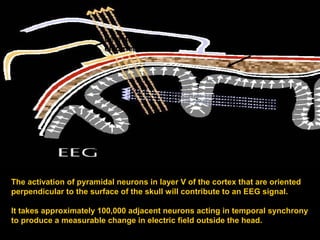 detectable
electrical field

undetectable
electrical field

undetectable
magnetic field

detectable
magnetic field

The activation of pyramidal neurons in layer V of the cortex that are oriented
perpendicular to the surface of the skull will contribute to an EEG signal.
It takes approximately 100,000 adjacent neurons acting in temporal synchrony
to produce a measurable change in electric field outside the head.

 