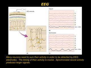 EEG

Many neurons need to sum their activity in order to be detected by EEG
electrodes. The timing of their activity is crucial. Synchronized neural activity
produces larger signals.

 