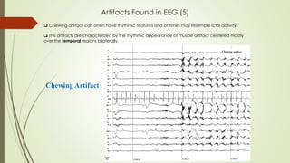 Artifacts Found in EEG (5)
Chewing Artifact
 Chewing artifact can often have rhythmic features and at times may resemble ictal activity.
 This artifacts are characterized by the rhythmic appearance of muscle artifact centered mostly
over the temporal regions bilaterally.
 