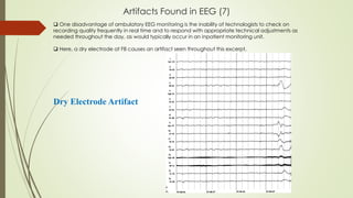 Artifacts Found in EEG (7)
Dry Electrode Artifact
 One disadvantage of ambulatory EEG monitoring is the inability of technologists to check on
recording quality frequently in real time and to respond with appropriate technical adjustments as
needed throughout the day, as would typically occur in an inpatient monitoring unit.
 Here, a dry electrode at F8 causes an artifact seen throughout this excerpt.
 