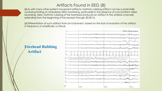 Artifacts Found in EEG (8)
Forehead Rubbing
Artifact
 As with many other patient movement artifacts, rhythmic rubbing artifact can be a potentially
confusing finding on ambulatory EEG monitoring, particularly in the absence of concomitant video
recording. Here, rhythmic rubbing of the forehead produces an artifact in the anterior channels,
extending from the beginning of this excerpt through 20:50:16.
 Differentiation of such artifact from an ictal event, based on the lack of evolution of the artifact
in frequency or amplitude, is critical.
 