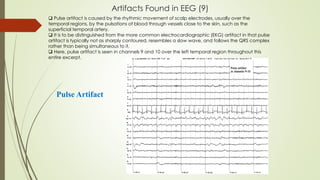 Artifacts Found in EEG (9)
Pulse Artifact
 Pulse artifact is caused by the rhythmic movement of scalp electrodes, usually over the
temporal regions, by the pulsations of blood through vessels close to the skin, such as the
superficial temporal artery.
 It is to be distinguished from the more common electrocardiographic (EKG) artifact in that pulse
artifact is typically not as sharply contoured, resembles a slow wave, and follows the QRS complex
rather than being simultaneous to it.
 Here, pulse artifact is seen in channels 9 and 10 over the left temporal region throughout this
entire excerpt.
 
