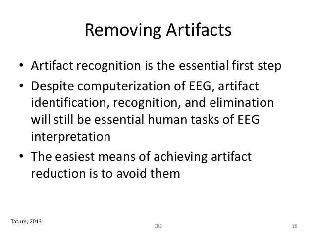 The Philosophy of EEG Interpretation