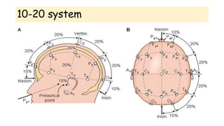 Eeg Introduction EEG Lecture- Introduction.pptx