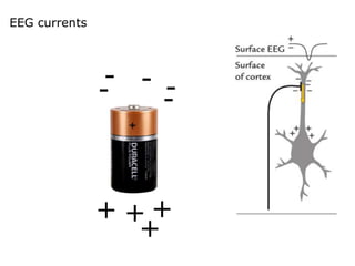 EEG currents
-
- -
-
-
+
+
+ +
 