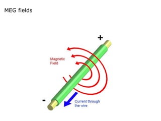 MEG fields
 