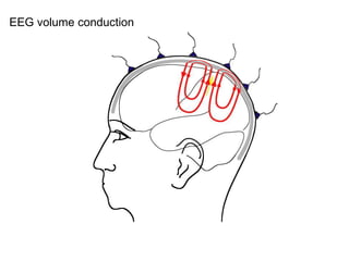 EEG volume conduction
 
