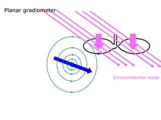 Environmental noise
Planar gradiometer
 