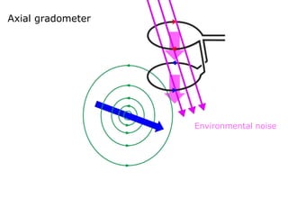 Axial gradometer
Environmental noise
 