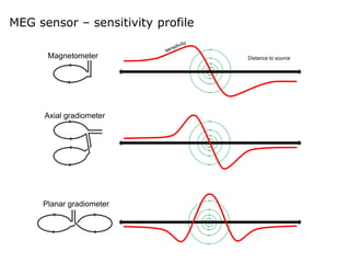 Magnetometer
Axial gradiometer
Planar gradiometer
Distance to source
MEG sensor – sensitivity profile
 
