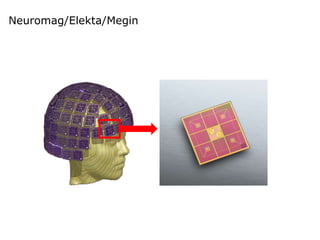 Neuromag/Elekta/Megin
 