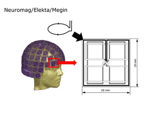 Neuromag/Elekta/Megin
 