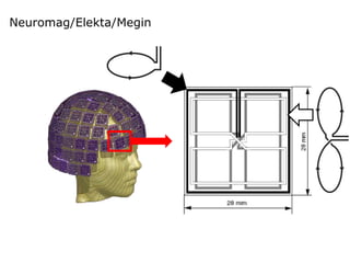Neuromag/Elekta/Megin
 