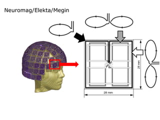 Neuromag/Elekta/Megin
 
