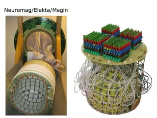 Neuromag/Elekta/Megin
 