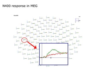 N400 response in MEG
400msec
 
