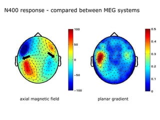 N400 response - compared between MEG systems
axial magnetic field planar gradient
 