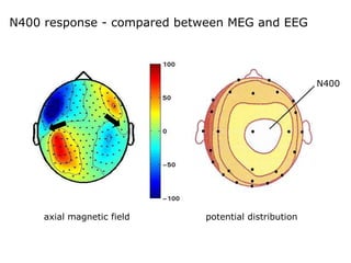N400 response - compared between MEG and EEG
axial magnetic field potential distribution
N400
 