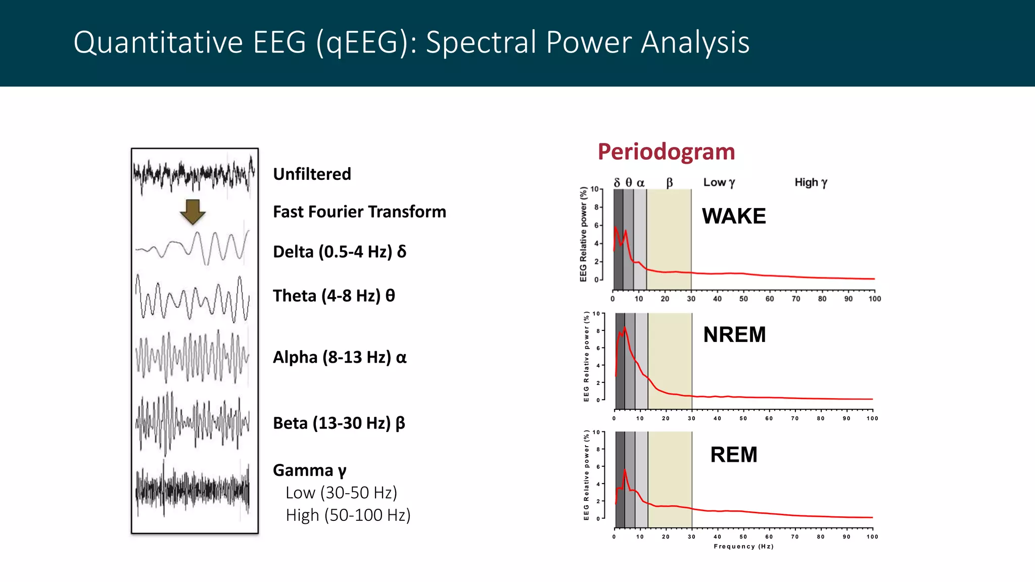 Harnessing EEG Methods to Improve Basic and Translational Research for ...