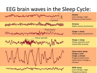 EEG brain waves in the Sleep Cycle:
 