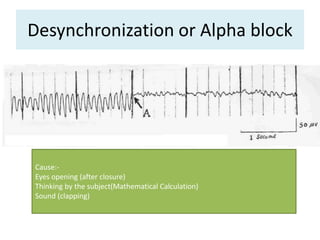 Desynchronization or Alpha block
Cause:-
Eyes opening (after closure)
Thinking by the subject(Mathematical Calculation)
Sound (clapping)
 