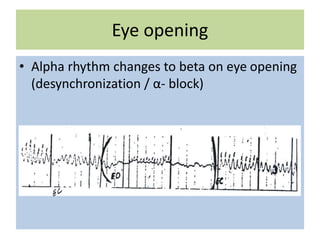 Eye opening
• Alpha rhythm changes to beta on eye opening
(desynchronization / α- block)
 