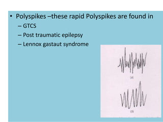 • Polyspikes –these rapid Polyspikes are found in
– GTCS
– Post traumatic epilepsy
– Lennox gastaut syndrome
 