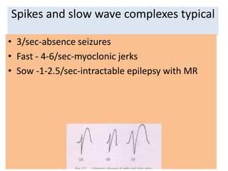 Spikes and slow wave complexes typical
• 3/sec-absence seizures
• Fast - 4-6/sec-myoclonic jerks
• Sow -1-2.5/sec-intractable epilepsy with MR
 