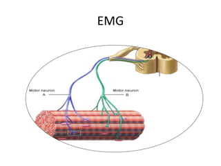 EMG
 