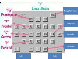 Nasopharyngeal
Temporal
Auricular
Occipital
Left Right
 