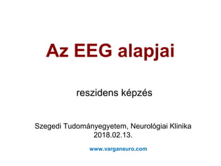 Az EEG alapjai
reszidens képzés
Szegedi Tudományegyetem, Neurológiai Klinika
2018.02.13.
www.varganeuro.com
 