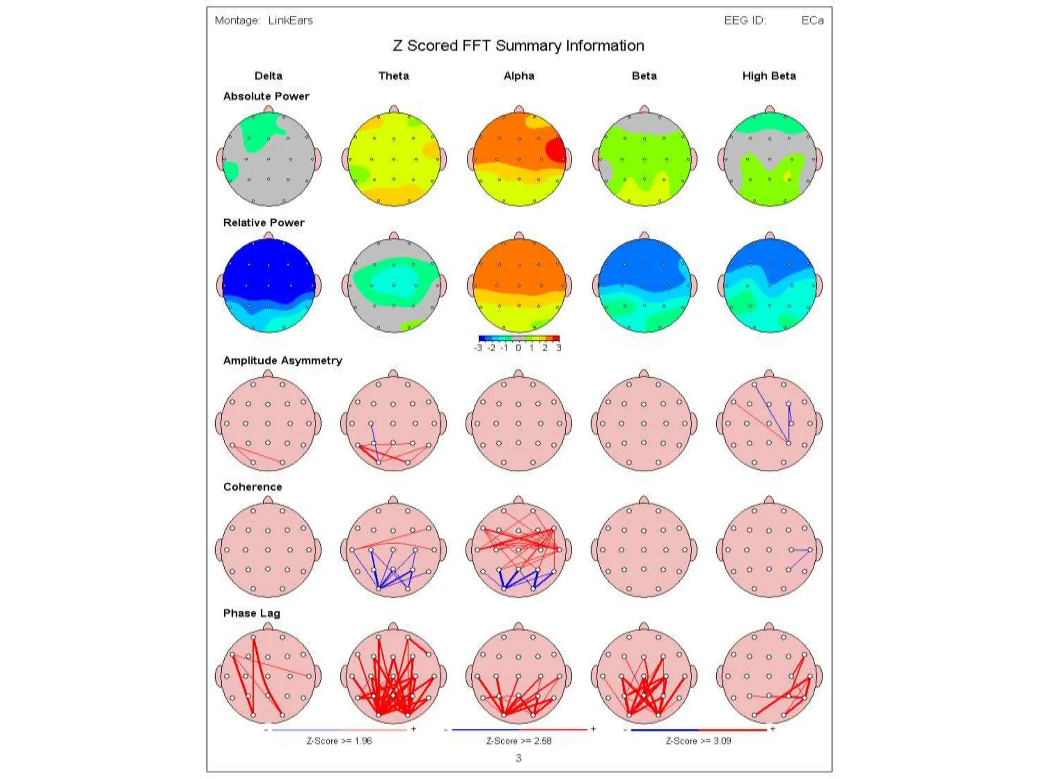 EEG signal processing and application to Neurofeedback : Operant ...