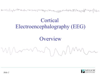 Cortical  Electroencephalography (EEG) Overview 