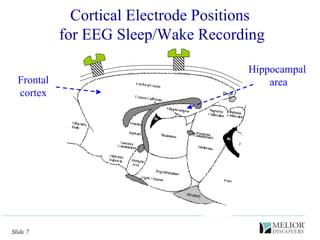 Cortical Electrode Positions  for EEG Sleep/Wake Recording Hippocampal  area Frontal cortex 