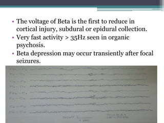 • The voltage of Beta is the first to reduce in
  cortical injury, subdural or epidural collection.
• Very fast activity > 35Hz seen in organic
  psychosis.
• Beta depression may occur transiently after focal
  seizures.
 