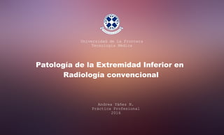Patología de la Extremidad Inferior en
Radiología convencional
Universidad de La Frontera
Tecnología Médica
Andrea Yáñez N.
Práctica Profesional
2016
 