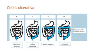 ENFERMEDAD INFLAMATORIA INTESTIANAL EN PEDIATRIA | PPTX