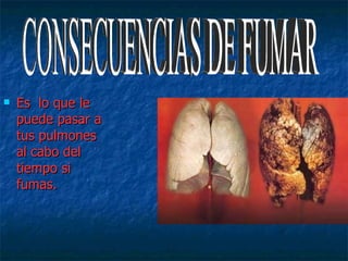 Es  lo que le puede pasar a tus pulmones  al cabo del tiempo si fumas. CONSECUENCIAS DE FUMAR 