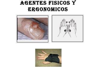 AGENTES FISICOS Y ERGONOMICOS 