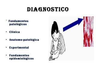 DIAGNOSTICO ´ Fundamentos   patológicos Clínica Anatomo-patológica Experimental Fundamentos epidemiológicos 