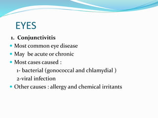 EYES
1. Conjunctivitis
 Most common eye disease
 May be acute or chronic
 Most cases caused :
1- bacterial (gonococcal and chlamydial )
2-viral infection
 Other causes : allergy and chemical irritants
 