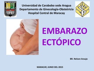 Universidad de Carabobo sede Aragua
Departamento de Ginecología-Obstetricia
Hospital Central de Maracay
BR. Nelson Araujo
EMBARAZO
ECTÓPICO
MARACAY, JUNIO DEL 2015
 