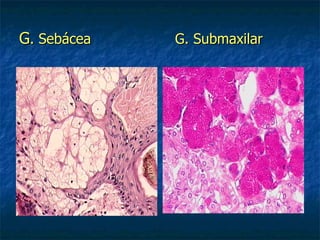 G. Sebácea   G. Submaxilar
 