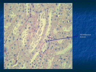 MEMBRANA
BASAL
 
